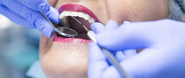 Best Dentist for Tooth Abscess  in Ecorse, MI
